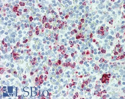 PathPlus™ LYZ / Lysozyme Antibody (clone BGN/0696/5B1)