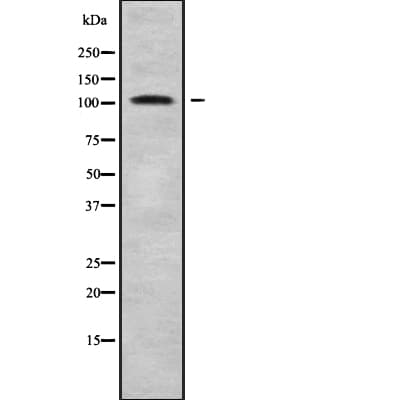 Polyclonal Rabbit anti-Human EDEM3 Antibody (WB)