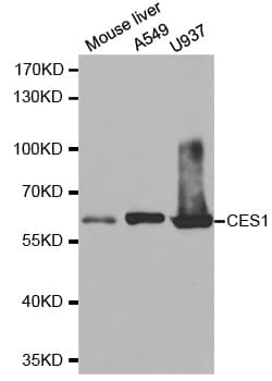IHC-plus™ Carboxylesterase 1 / CES1 Antibody