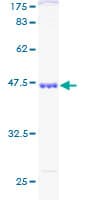 Human SKP1 Protein (Recombinant GST)