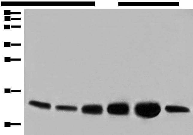 Polyclonal Rabbit anti-Human COX6C Antibody (IHC, WB)