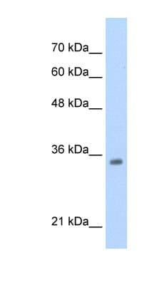 TCF4 Antibody (aa73-122)