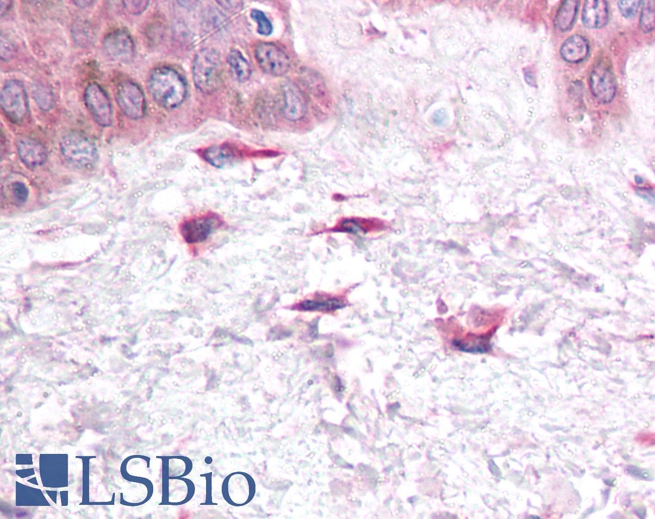 Polyclonal Rabbit anti-Human SDF1 / CXCL12 Antibody (C-Terminus, IHC, WB)
