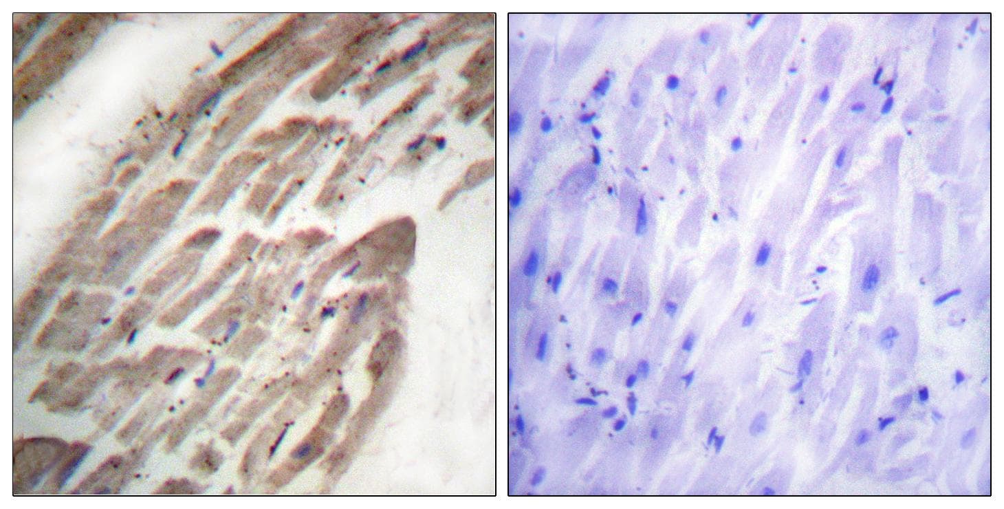 Polyclonal Rabbit anti-Human NFATC1 / NFAT2 Antibody (phospho-Ser294, IHC)