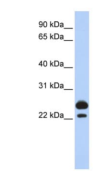 AK1 / Adenylate Kinase 1 Antibody (aa108-157)