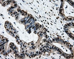 SORD / Sorbitol Dehydrogenase Antibody (clone OTI15H2)
