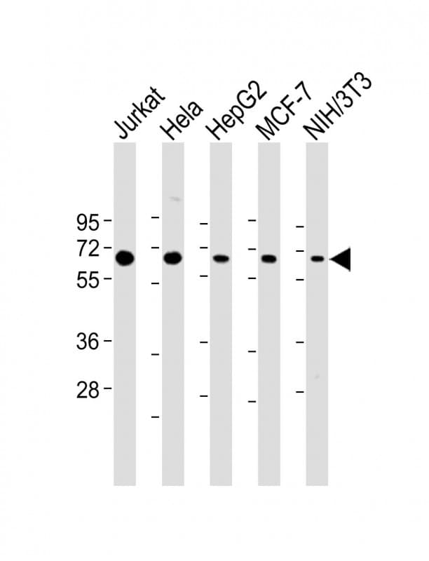 p58 / PSMD3 Antibody (C-Terminus)