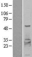 PHKG2 Protein (Over-Expression Lysate Myc-DDK (Flag))