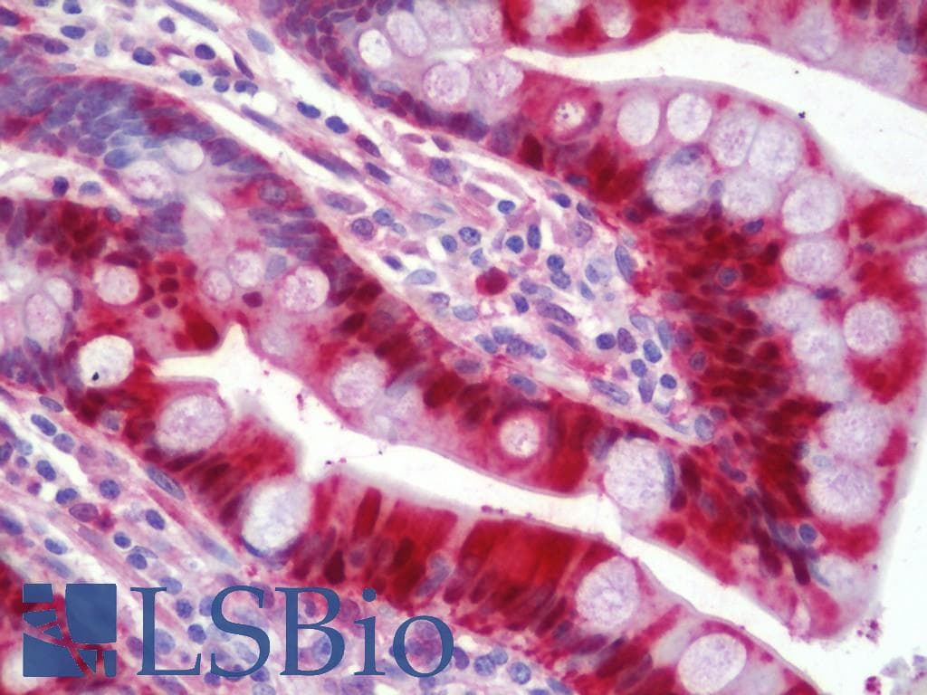 IHC-plus™ LGALS3 / Galectin 3 Antibody (clone 52C1)