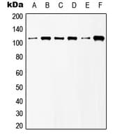 GRM6 / MGLUR6 Antibody (C-Terminus)