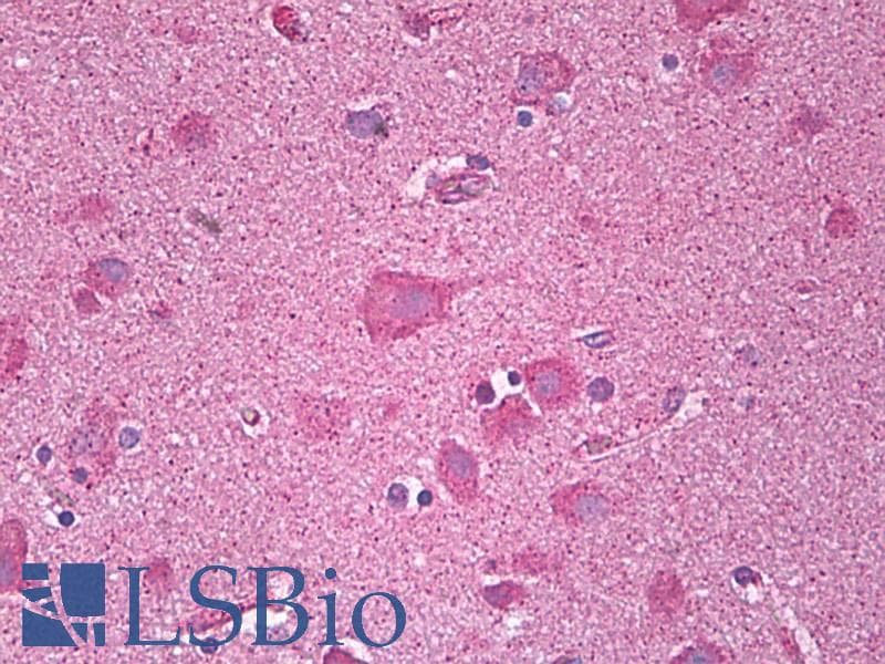 IHC-plus™ CXCR3 Antibody (aa161-210)