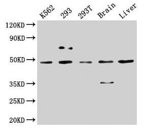 Polyclonal Rabbit anti-Human CSNK1D Antibody (IHC)