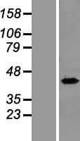 Human RPL8 / Ribosomal Protein L8 (Over-Expression Lysate Myc-DDK (Flag))