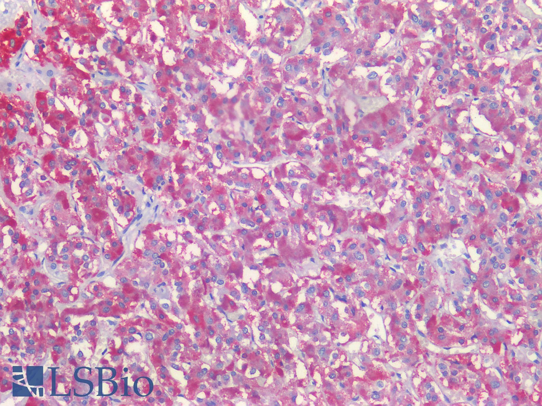 PathPlus™ Polyclonal Rabbit anti-Human TGFB2 / TGF Beta2 Antibody (aa361-410, IHC)