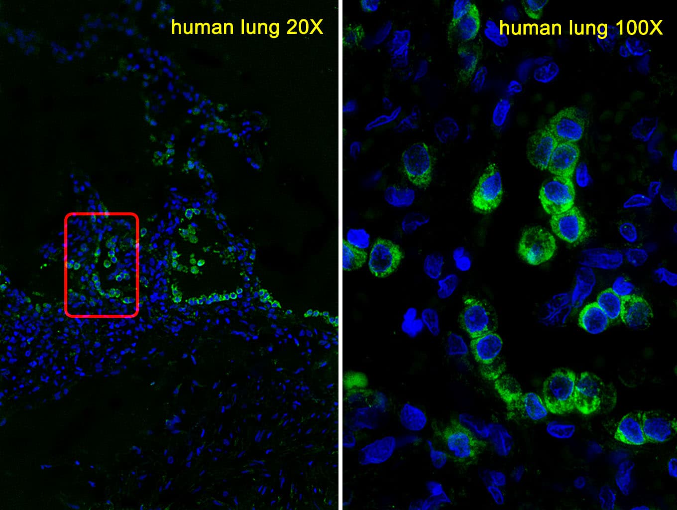 IHC-plus™ SFTPC / Surfactant Protein C Antibody (aa1-30)