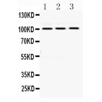 Polyclonal Rabbit anti-Human RASA1 Antibody (aa1018-1047, WB)