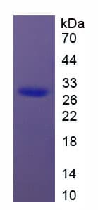 Rat HMG1 / HMGB1 Protein (Recombinant His)