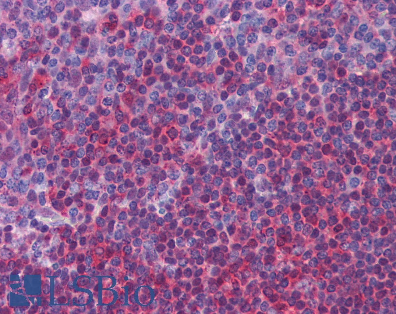 IHC-plus™ ERK1 + ERK2 Antibody