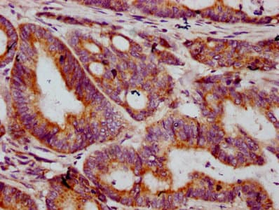 Polyclonal Rabbit anti-Human MT-CO2 Antibody (IHC, WB)