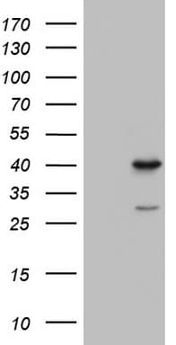TFB1M Antibody (aa116-346, clone OTI10H8)