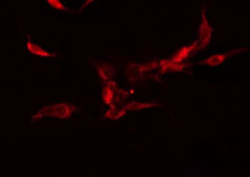 CD135 / FLT3 Antibody