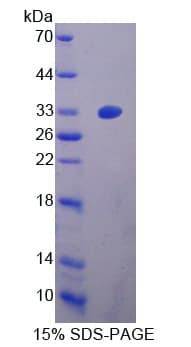 Human ITGA2 / CD49b Protein (Recombinant His-T7)