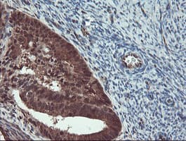 TRAIP / TRIP Antibody (aa67-313, clone OTI2D4, Carrier-free)