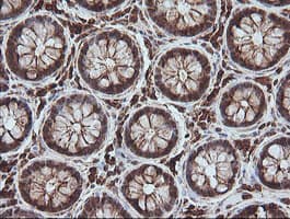 MAGEA4 Antibody (clone OTI2C1)
