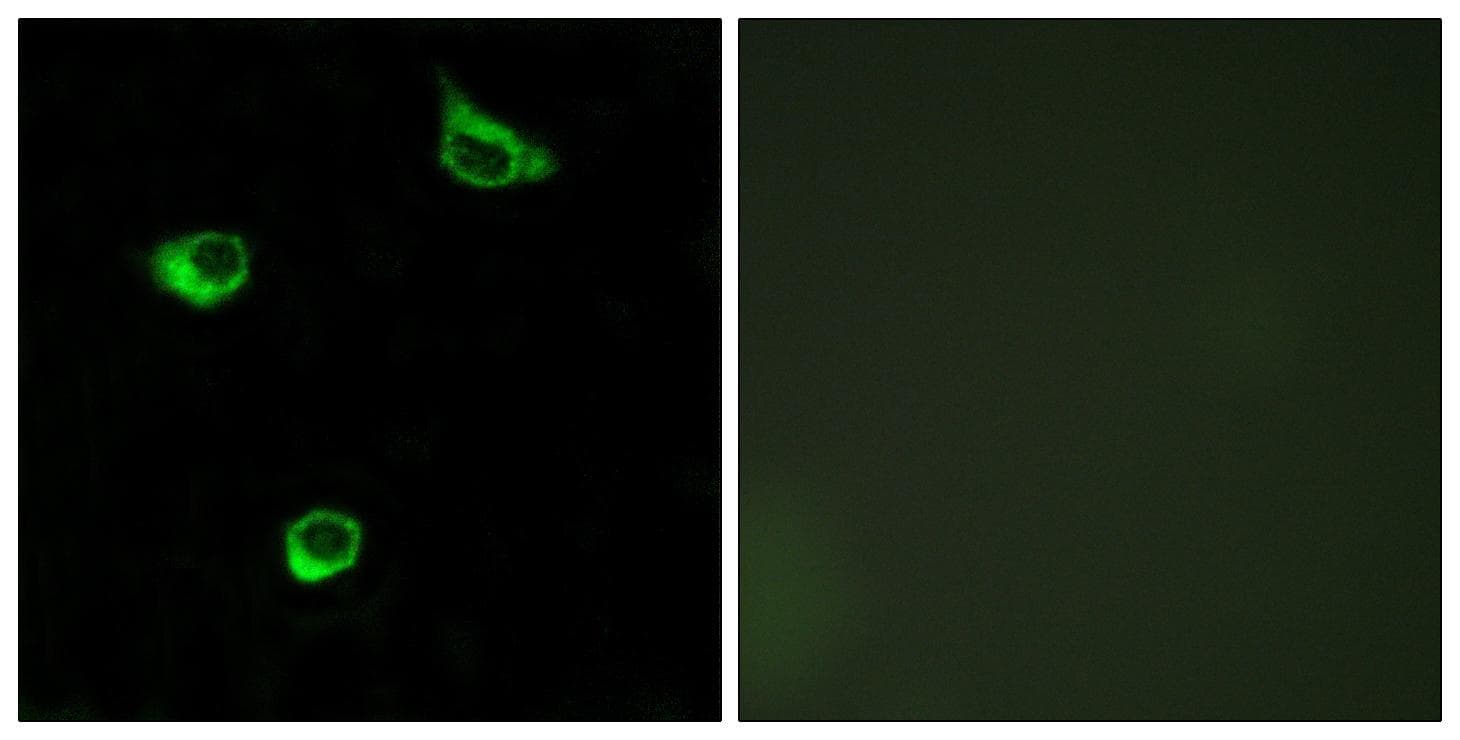 FZD6 / Frizzled 6 Antibody