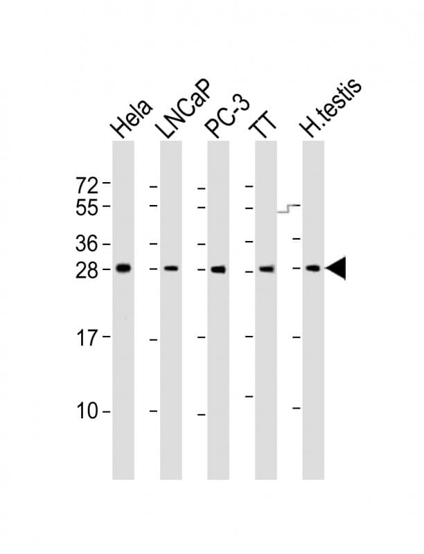 SSX1 Antibody (aa97-128)