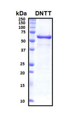 Human DNTT / TdT Protein (Recombinant His, N-Terminal)