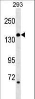 ARHGEF18 Antibody (aa91-119)