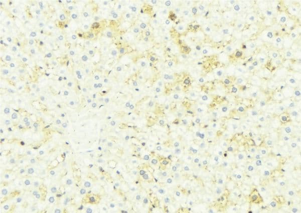 CES2 / Esterase Antibody