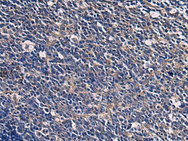 Polyclonal Rabbit anti-Human ABHD14B Antibody (IHC, WB)
