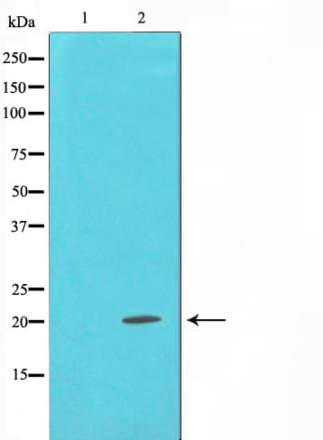 SNCA / Alpha-Synuclein Antibody