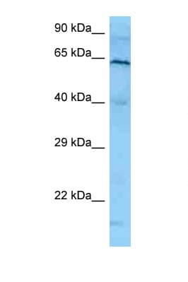 Polyclonal Rabbit anti-Human PLK1 / PLK-1 Antibody (N-Terminus, WB)