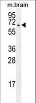 FBXO21 Antibody (aa474-501)