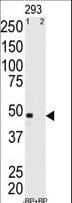 MAGEA11 Antibody (aa198-228)