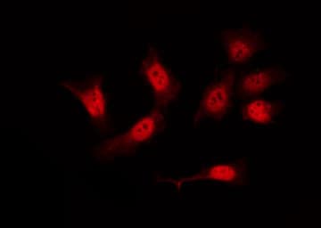 Polyclonal Rabbit anti-Human FLNA / Filamin A Antibody (IHC, IF, WB)