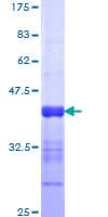 Human NFAT5 Protein (Recombinant GST, N-terminus)