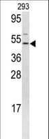 IHC-plus™ FLI1 Antibody (aa52-80)