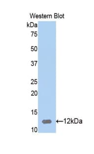Calgizzarin / S100A11 Antibody (aa9-98)