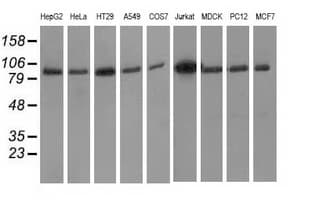 Monoclonal Mouse anti-Human PRKD2 / PKD2 Antibody (clone OTI3B12, IF, WB)