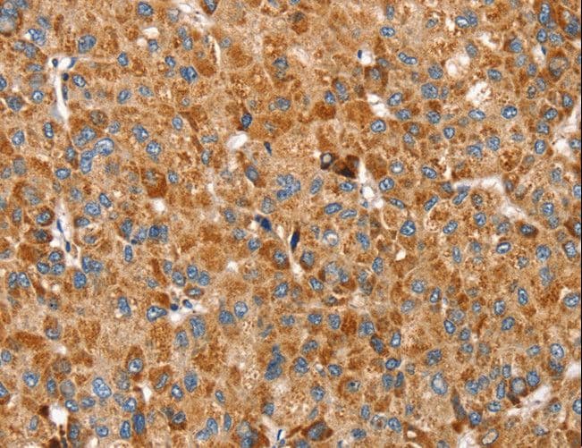 Polyclonal Rabbit anti-Human SSBP1 / mtSSB Antibody (IHC, WB)