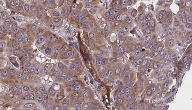 Polyclonal Rabbit anti-Human BIN2 Antibody (IHC, WB)