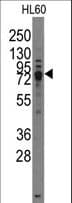 IHC-plus™ TRPV3 Antibody (aa662-692)
