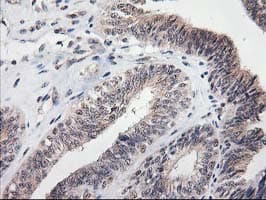 MGLL / Monoacylglycerol Lipase Antibody (clone OTI4D1)