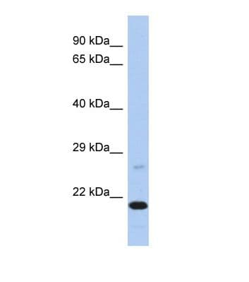 PPOX Antibody (C-Terminus)