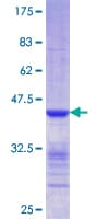 Human CLIC5 Protein (Recombinant GST, N-terminus)