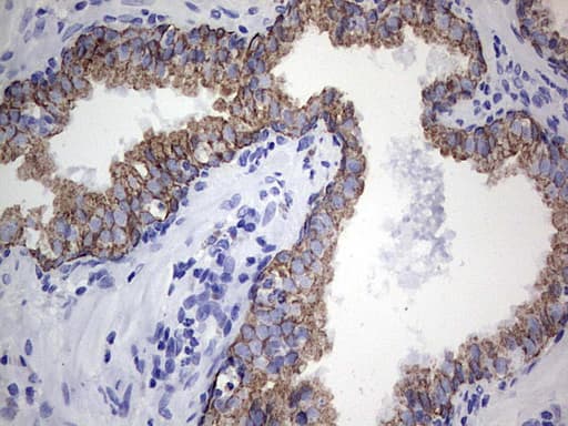 Acidic Cytokeratin Antibody (clone 8A3)